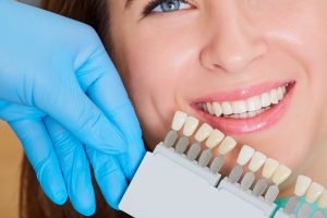 Close-up of a girl with a beautiful smile at the dentist. Dental care concept. Set of implants with various shades of tone