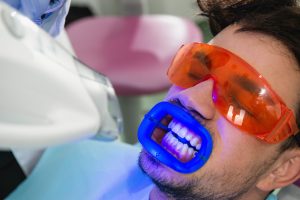 Teeth whitening procedure