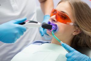 Girl patient in the dental clinic. Teeth whitening UV lamp with photopolymer composition.